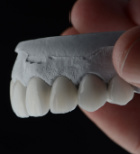 כל מה שאתם צריכים לדעת על שיקום הפה-תמונה